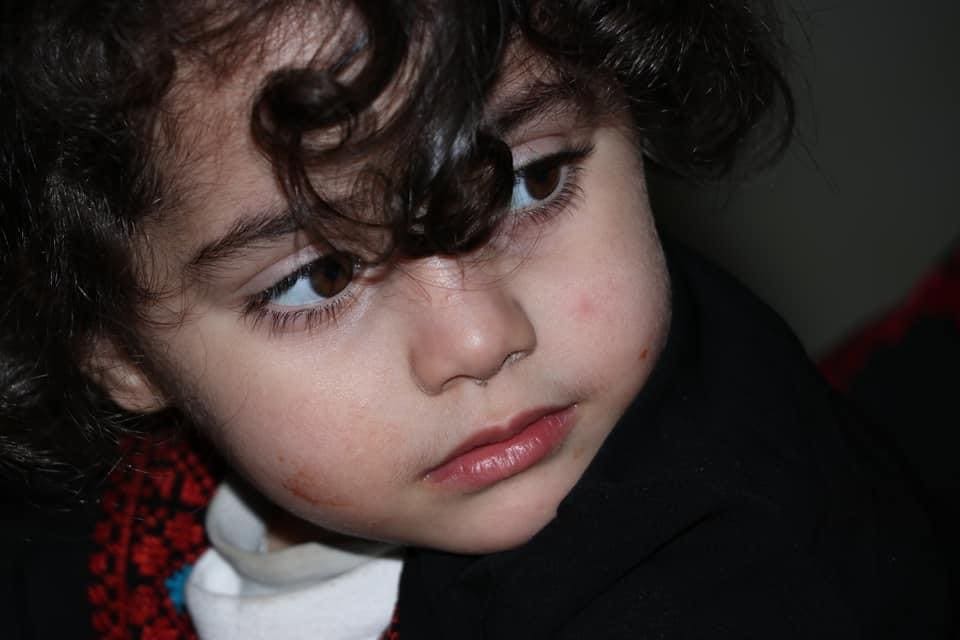 Child with thoughtful expression